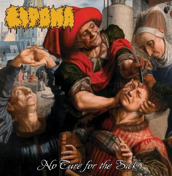 Lipoma - No Cure for the Sick (2025)